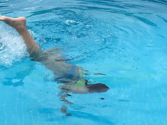Alanya’da havuza balıklama atlayan genç hastanelik oldu